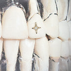 18K Gold Tooth Gems – Crystal Sparkle Star