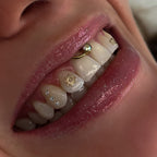 18K Gold Tooth Gems – Sun