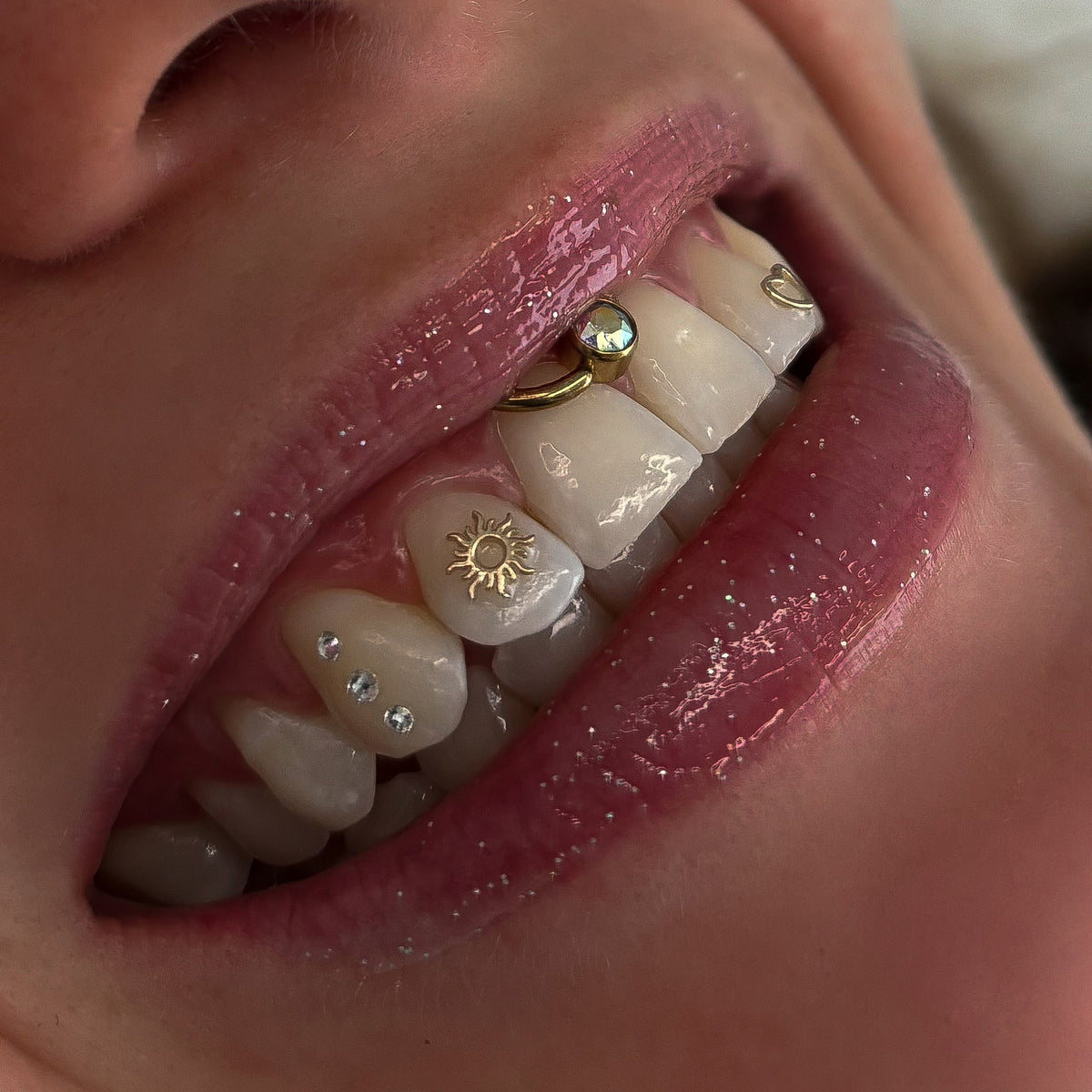 18K Gold Tooth Gems – Sun