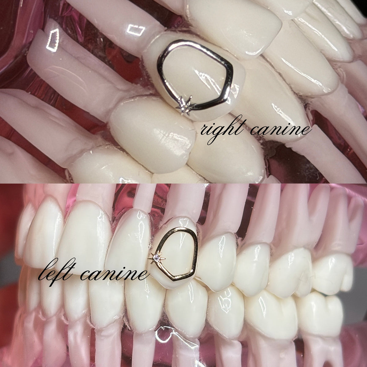 18K Gold Tooth Gems – Crystal Star Cap