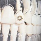 18K Gold Tooth Gems – Sun