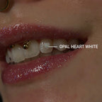 Opals - Tooth Gems