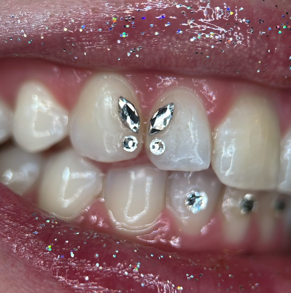 Swarovski Marquise Tooth Gem